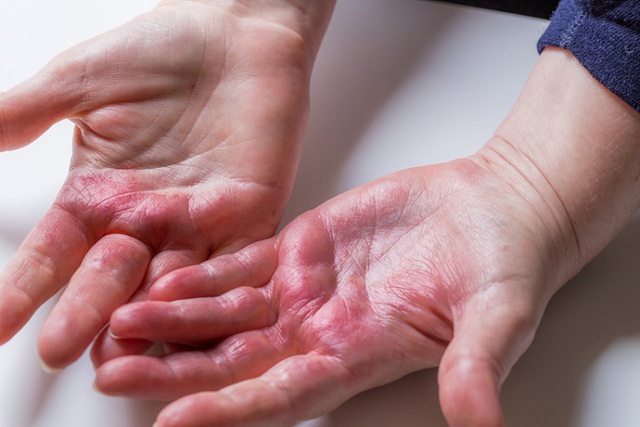 “3 ngứa, 2 đau” thực chất là triệu chứng ung thư gan giai đoạn đầu dễ bị bỏ qua nhất- Ảnh 1.
