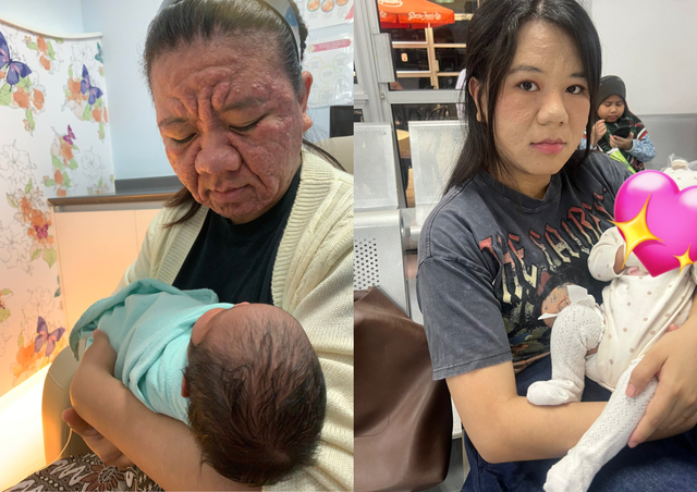Xót xa gương mặt biến dạng sau khi mang thai của người mẹ trẻ, nhìn lại nhan sắc xinh đẹp trước đó càng không dám tin- Ảnh 2. Xót xa gương mặt biến dạng sau khi mang thai của người mẹ trẻ, nhìn lại nhan sắc xinh đẹp trước đó càng không dám tin- Ảnh 2.