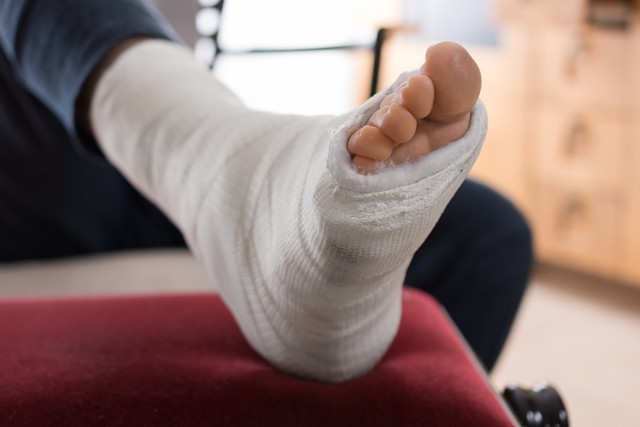4 dấu hiệu "lạ" ở chân cảnh báo phổi "chi chít khối u", cần khám nhanh kẻo muộn!- Ảnh 3.
