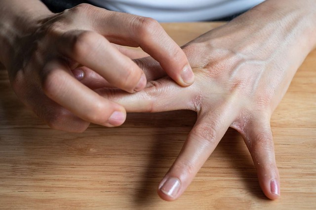 2 bộ phận trên cơ thể hay ngứa ngáy là dấu hiệu ung thư gan, nhiều người dễ lầm tưởng là dị ứng- Ảnh 1.