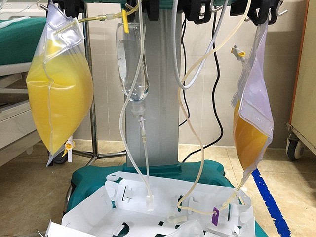 Hút ra gần 2 lít "dầu" từ trong máu người phụ nữ "thập tử nhất sinh" vì ăn thịt lợn kiểu này- Ảnh 1.
