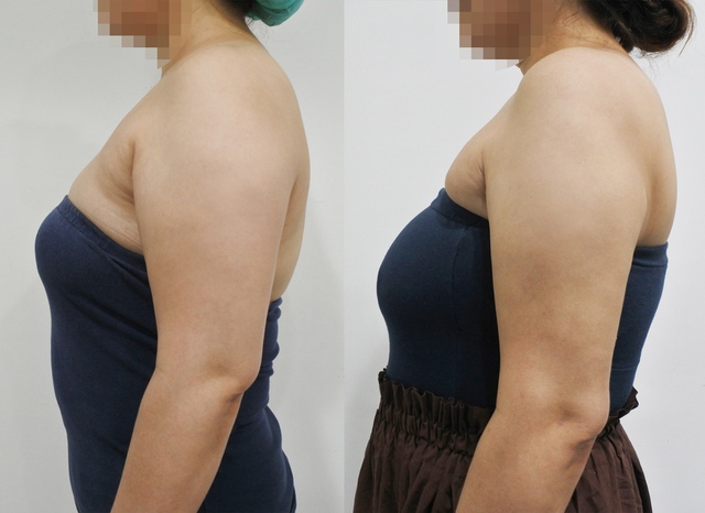 Phụ nữ béo lên thật hay không NHÌN VÀO 3 ĐIỂM trên cơ thể biết ngay, giai đoạn tiền mãn kinh càng rõ- Ảnh 2.