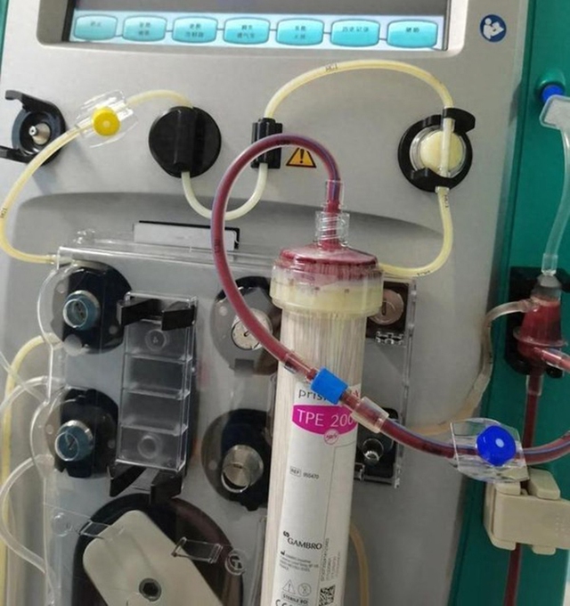 Chàng trai 19 tuổi máu đục như sữa, suy đa tạng nguy kịch vì 2 kiểu LƯỜI người trẻ rất thích- Ảnh 2.