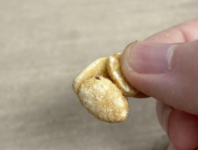 Ng&agrave;y c&agrave;ng c&oacute; nhiều người chết v&igrave; ung thư gan? B&aacute;c sĩ vạch trần: 4 thực phẩm "ph&aacute; gan" nhanh c&ograve;n hơn bia rượu- Ảnh 1.