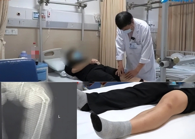 Ngo&agrave;i 30 tuổi xương đ&atilde; "xốp như tổ ong", ho cũng g&atilde;y xương đ&ugrave;i v&igrave; m&ecirc; loại nước "ng&ograve;n ngọt", uống t&ecirc; đầu lưỡi- Ảnh 1.