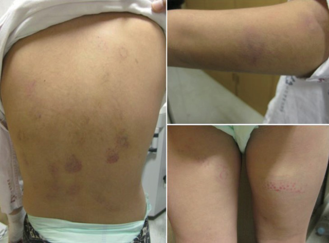 Cặp vợ chồng tiểu ra máu, suy hô hấp sau khi ăn cải thảo non: Chuyện gì đã xảy ra?- Ảnh 3. Cặp vợ chồng tiểu ra máu, suy hô hấp sau khi ăn cải thảo non: Chuyện gì đã xảy ra?- Ảnh 3.