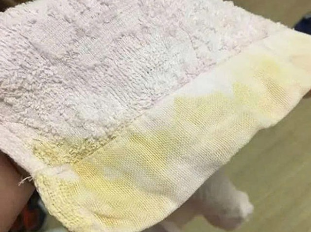 Một người đứng bếp, cả nh&agrave; ung thư? B&aacute;c sĩ cảnh b&aacute;o 5 thứ để trong bếp &acirc;m thầm "đầu độc" cả gia đ&igrave;nh - Ảnh 4.