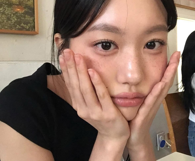 5 loại thực phẩm TỒI TỆ nhất cho da được bác sĩ phẫu thuật thẩm mỹ tiết lộ: Ăn ít thôi!- Ảnh 1.