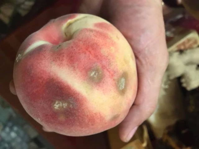 Ng&agrave;y c&agrave;ng nhiều nam giới c&ograve;n trẻ đ&atilde; mắc ung thư gan, b&aacute;c sĩ n&oacute;i thẳng: 5 thứ n&agrave;y "ph&aacute; gan" hơn bia rượu- Ảnh 1.