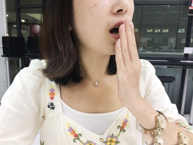 Ngày càng nhiều người còn trẻ đã chết vì ung thư gan? Bác sĩ nhắc: Đừng bỏ lỡ "2 hôi, 2 ngứa, 2 đỏ" đang báo bệnh- Ảnh 3.