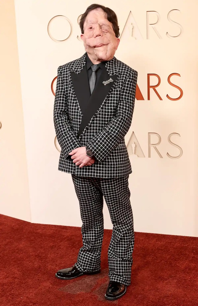 Siêu thảm đỏ Oscar 2026: Anne Hathaway - Emma Stone visual đại chiến, Timothée Chalamet có so kè được nam thần Đồi Gió Hú?- Ảnh 35.