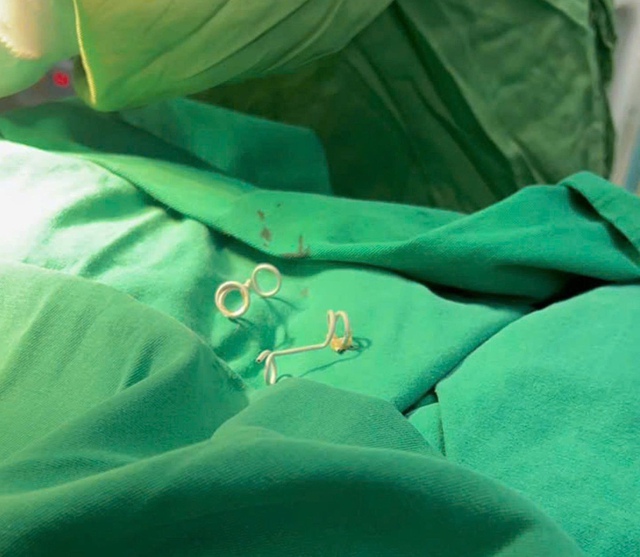 Em b&eacute; sinh ra với "đ&ocirc;i c&aacute;nh nhỏ" tr&ecirc;n lưng: Mẹ ơi! Con đến với mẹ rồi đ&acirc;y!- Ảnh 3.