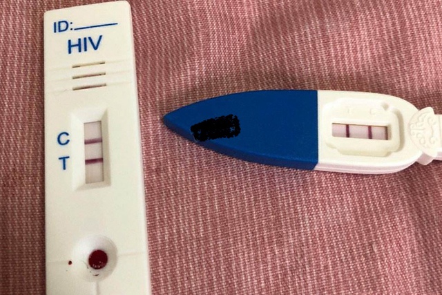 Người đ&agrave;n &ocirc;ng 30 tuổi bất ngờ ph&aacute;t hiện nhiễm HIV khi đi kh&aacute;m mắt, b&aacute;c sĩ: Đừng xem nhẹ 4 điều! - Ảnh 2.