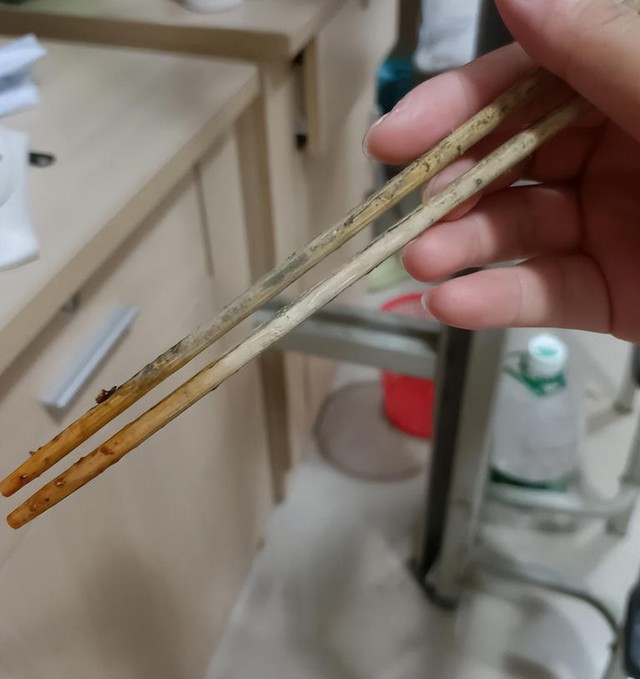 Ph&aacute;t hiện chất kịch độc, gấp thạch t&iacute;n 68 lần trong dạ d&agrave;y người phụ nữ mắc ung thư: 5 năm kh&ocirc;ng chịu thay 1 thứ - Ảnh 3.
