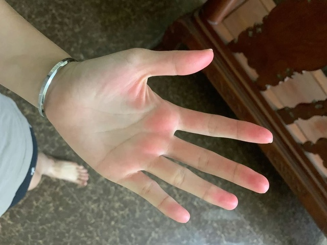 Nếu c&oacute; đủ 5 thứ tr&ecirc;n b&agrave;n tay th&igrave; xin ch&uacute;c mừng! Gan của bạn khả năng cao vẫn c&ograve;n rất khỏe - Ảnh 1.