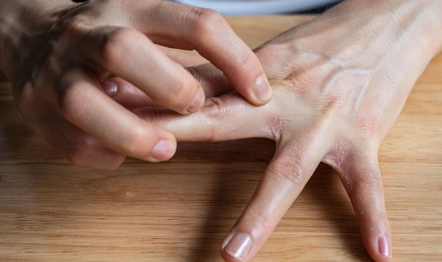 Nếu c&oacute; đủ 5 thứ tr&ecirc;n b&agrave;n tay th&igrave; xin ch&uacute;c mừng! Gan của bạn khả năng cao vẫn c&ograve;n rất khỏe - Ảnh 3.