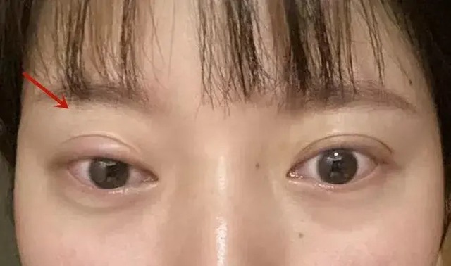 Nếu mắt c&oacute; 6 thứ, đi kh&aacute;m ung thư ngay c&ograve;n kịp! - Ảnh 4.