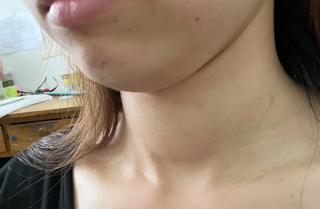 Người phụ nữ 36 tuổi sống l&agrave;nh mạnh, KH&Ocirc;NG rượu hay thuốc vẫn mắc suy gi&aacute;p, b&aacute;c sĩ: 4 m&oacute;n ngon n&agrave;y ăn &iacute;t đi! - Ảnh 1.