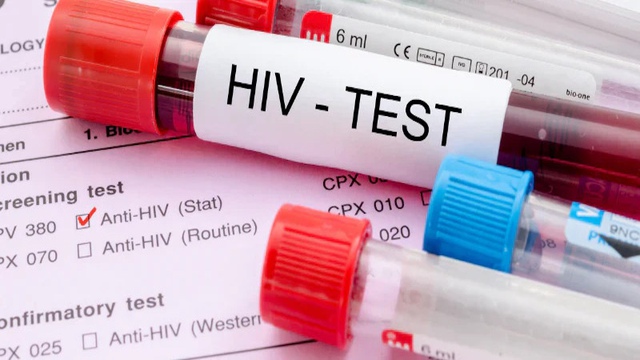 Nữ gi&aacute;o vi&ecirc;n đột ngột ph&aacute;t hiện mắc HIV, b&aacute;c sĩ vạch trần 7 quan niệm sai lầm về HIV rất nhiều người mắc phải - Ảnh 1.