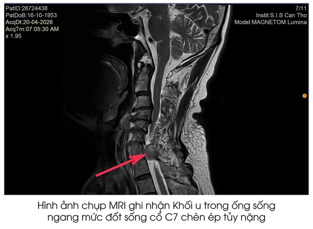 &Ocirc;ng l&atilde;o bị bệnh hiếm gặp dễ bị nhầm lẫn v&agrave; bỏ s&oacute;t - Ảnh 1.