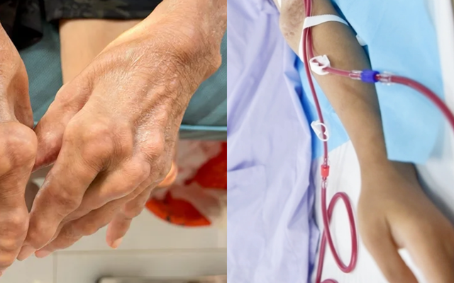Nhắc nhở: 5 loại đồ uống thường ng&agrave;y đang ngấm ngầm "bơm" axit uric v&agrave;o cơ thể, loại đầu chẳng ai ngờ tới - Ảnh 1.