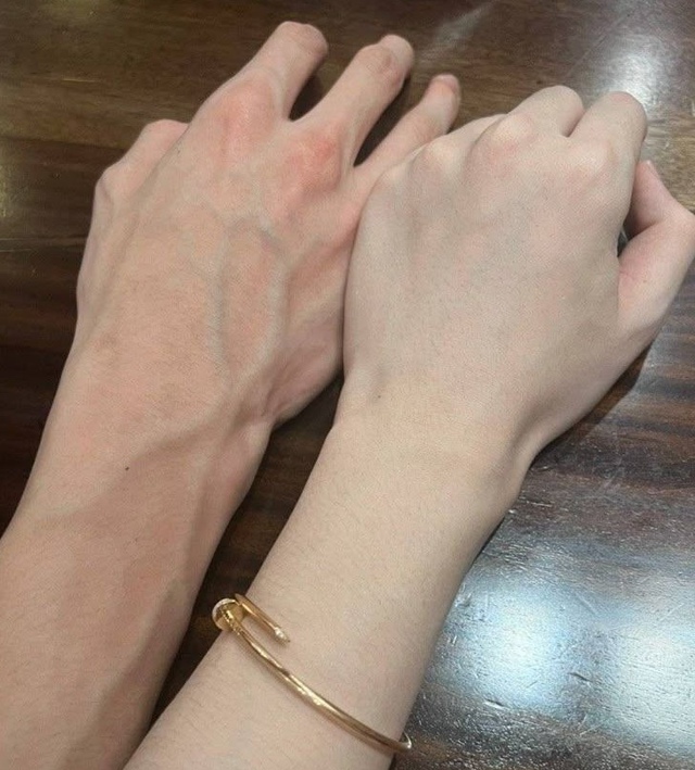 4 thứ tr&ecirc;n cơ thể c&agrave;ng mềm th&igrave; c&agrave;ng sống l&acirc;u, c&oacute; c&oacute; đủ cả bạn quả l&agrave; may mắn! - Ảnh 1.