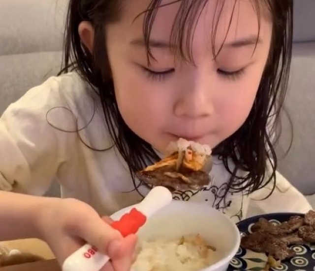 Bé gái 8 tuổi đã khổ sở vì gan nhiễm mỡ, bác sĩ tức giận: Đừng khen con thế này nữa! - Ảnh 3.