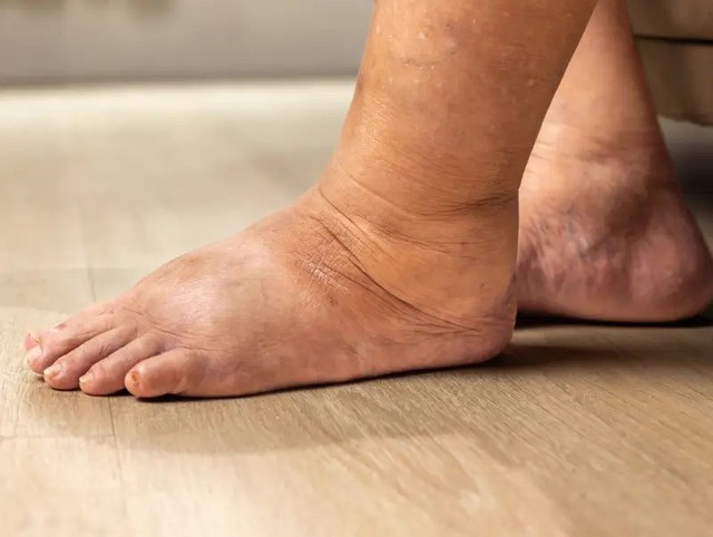 Ch&agrave;ng trai 25 tuổi su&yacute;t chết v&igrave; suy tim, l&ecirc;n mạng cảnh b&aacute;o: "Xin đừng l&agrave;m việc n&agrave;y mỗi đ&ecirc;m&hellip;" - Ảnh 2.