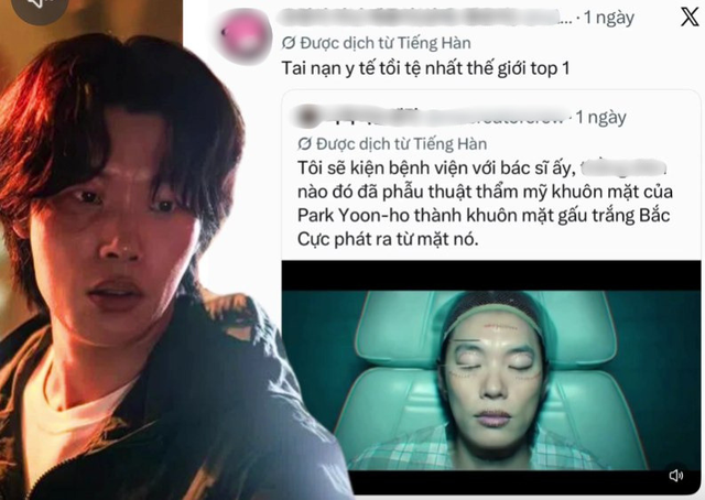 Top 1 tai nạn y tế tồi tệ nhất thế giới: Tốn tiền sửa mặt m&agrave; lại xấu đi, 7 triệu người đ&ograve;i kiện b&aacute;c sĩ - Ảnh 1.