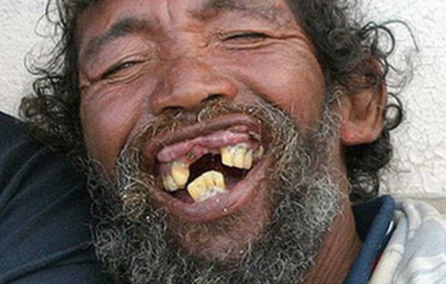 TẠI SAO MỘT SỐ NGƯỜI SINH RA LẠI CÓ CÁI MIỆNG NHỎ ?