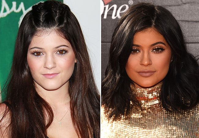 Thừa nhận bơm môi, nhưng Kylie Jenner khẳng định vòng 3 to bất thường là hàng thật - Ảnh 4.