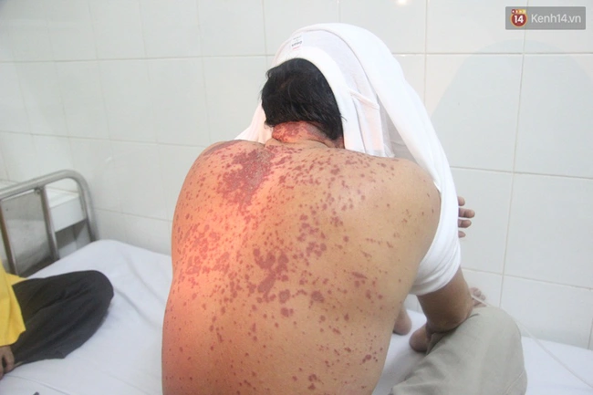 Sự thực việc một người ở Nghệ An nhập viện sau khi ăn cá biển - Ảnh 1.