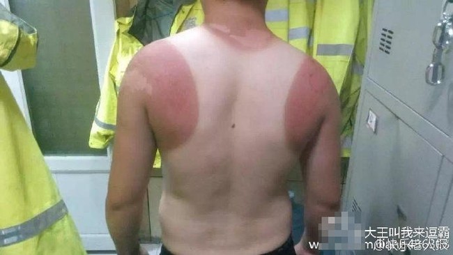 Bức ảnh khoe lưng trần cháy nắng của chàng cảnh sát giao thông khiến nhiều người không khỏi xót xa - Ảnh 1.