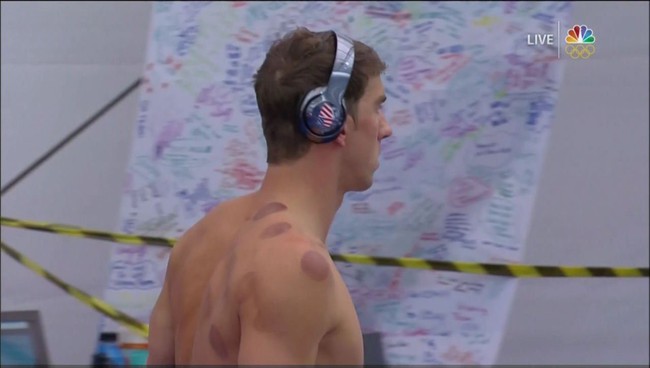 Bí ẩn những vòng tròn đỏ trên người siêu kình ngư Michael Phelps - Ảnh 2.