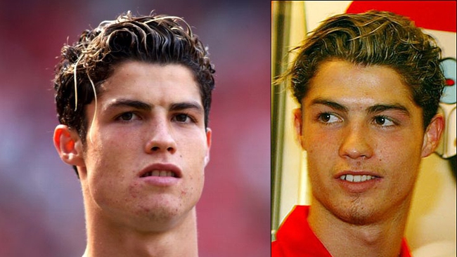 Ronaldo ngày càng đẹp trai nhờ phẫu thuật thẩm mỹ - Ảnh 2.