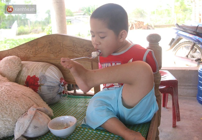 Đ&ocirc;i ch&acirc;n kỳ diệu của cậu b&eacute; mồ c&ocirc;i kh&ocirc;ng tay ở Quảng Trị - Ảnh 2.