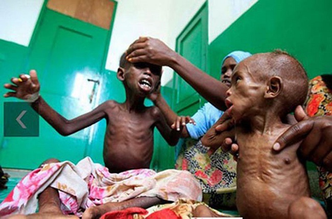Chùm ảnh những đứa trẻ châu Phi gầy trơ xương vì đói sẽ khiến bạn không dám bỏ thừa đồ ăn thêm nữa - Ảnh 4.