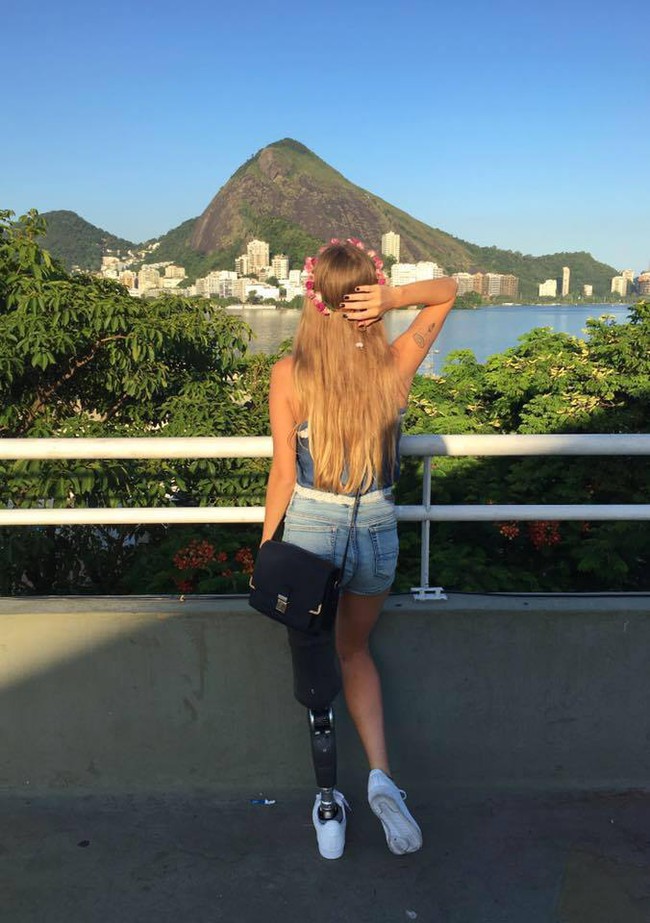 Hãy theo dõi Instagram của cô gái 1 chân vô cùng xinh đẹp này, nếu bạn đang cần một mục tiêu sống - Ảnh 4.