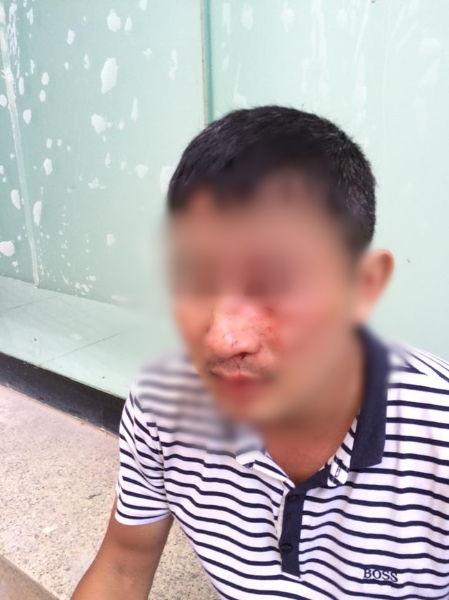 Vì 30.000 đồng, người đàn ông ở Hà Nội cầm vợt tennis đánh shipper gãy mũi - Ảnh 4.