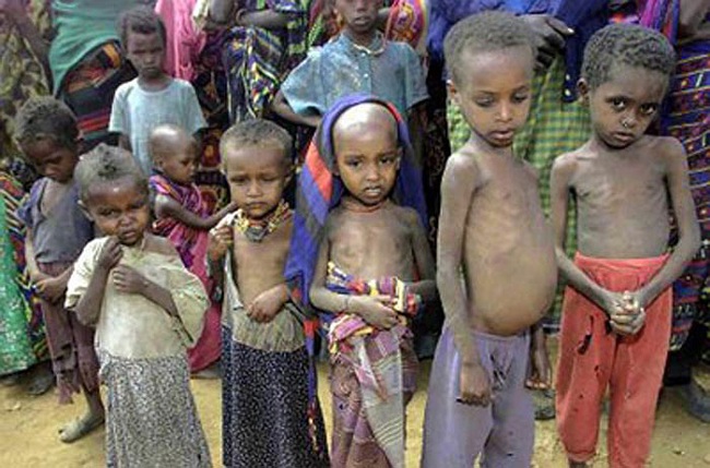 Chùm ảnh những đứa trẻ châu Phi gầy trơ xương vì đói sẽ khiến bạn không dám bỏ thừa đồ ăn thêm nữa - Ảnh 14.