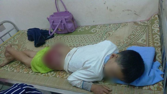 H&igrave;nh ảnh g&acirc;y phẫn nộ: B&eacute; trai 13 tuổi bị cha ruột đ&aacute;nh tứa m&aacute;u - Ảnh 2.