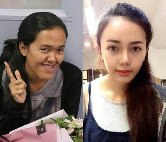 9x Th&aacute;i từng bị nhận x&eacute;t l&agrave; x&uacute;c phạm người nh&igrave;n, v&agrave; cuộc lột x&aacute;c ngoạn mục sau PTTM  - Ảnh 3.