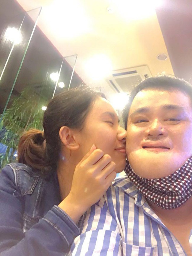 Chuyện t&igrave;nh cảm động của ch&agrave;ng trai bỏng nặng đến biến dạng khu&ocirc;n mặt v&agrave; c&ocirc; g&aacute;i Bắc Giang xinh đẹp - Ảnh 4.