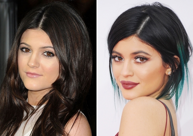 Kylie Jenner hối hận vì từng bơm môi quá đà - Ảnh 2.