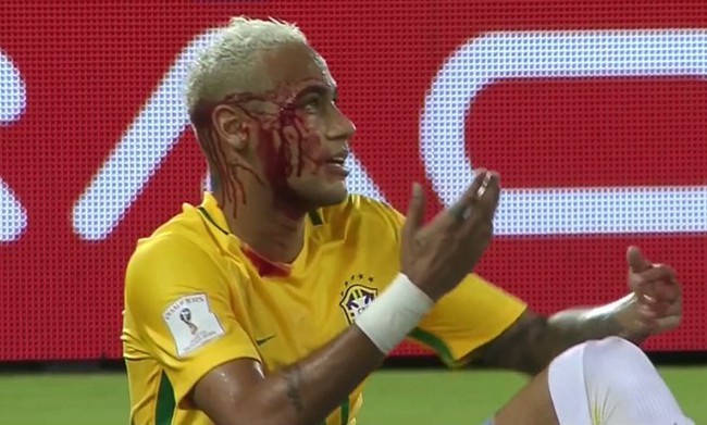 Neymar chảy máu lênh láng trong chiến thắng 5 sao của Brazil - Ảnh 6.