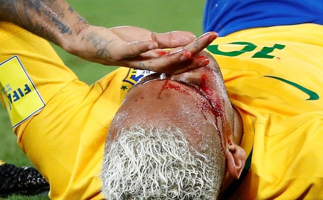 Neymar chảy máu lênh láng trong chiến thắng 5 sao của Brazil - Ảnh 7.