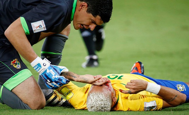 Neymar chảy máu lênh láng trong chiến thắng 5 sao của Brazil - Ảnh 8.