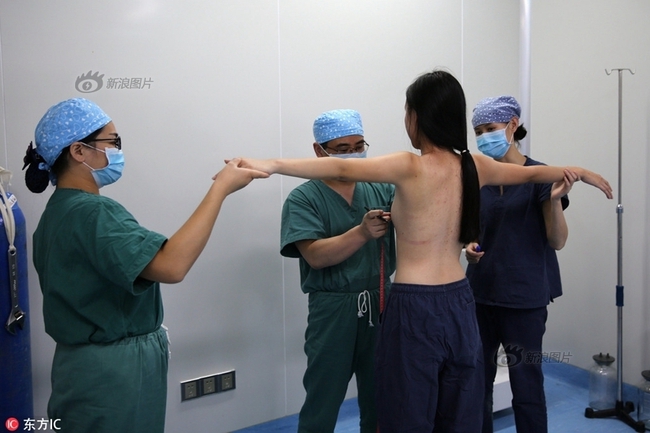 &Aacute; qu&acirc;n cuộc thi sắc đẹp Trung Quốc g&acirc;y bất ngờ khi tiết lộ to&agrave;n bộ qu&aacute; tr&igrave;nh dao k&eacute;o - Ảnh 3.