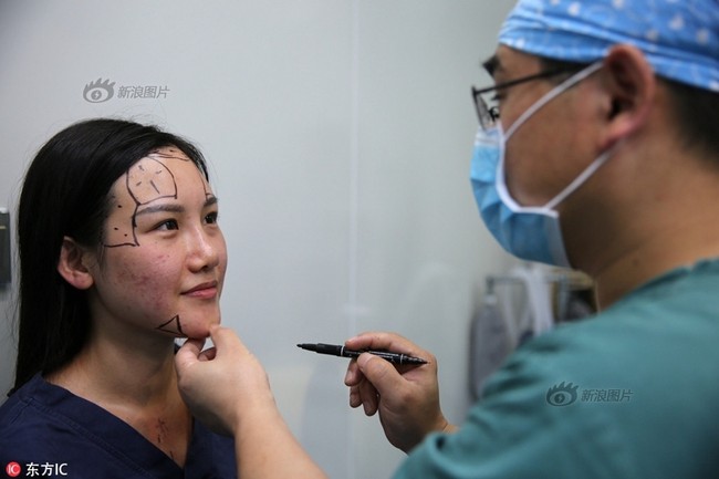 &Aacute; qu&acirc;n cuộc thi sắc đẹp Trung Quốc g&acirc;y bất ngờ khi tiết lộ to&agrave;n bộ qu&aacute; tr&igrave;nh dao k&eacute;o - Ảnh 4.