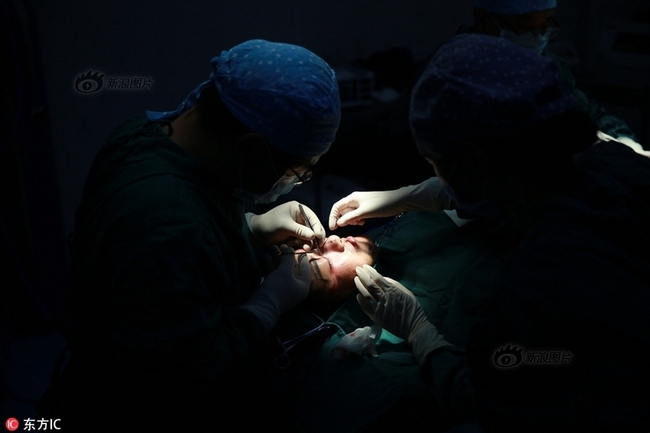 &Aacute; qu&acirc;n cuộc thi sắc đẹp Trung Quốc g&acirc;y bất ngờ khi tiết lộ to&agrave;n bộ qu&aacute; tr&igrave;nh dao k&eacute;o - Ảnh 5.